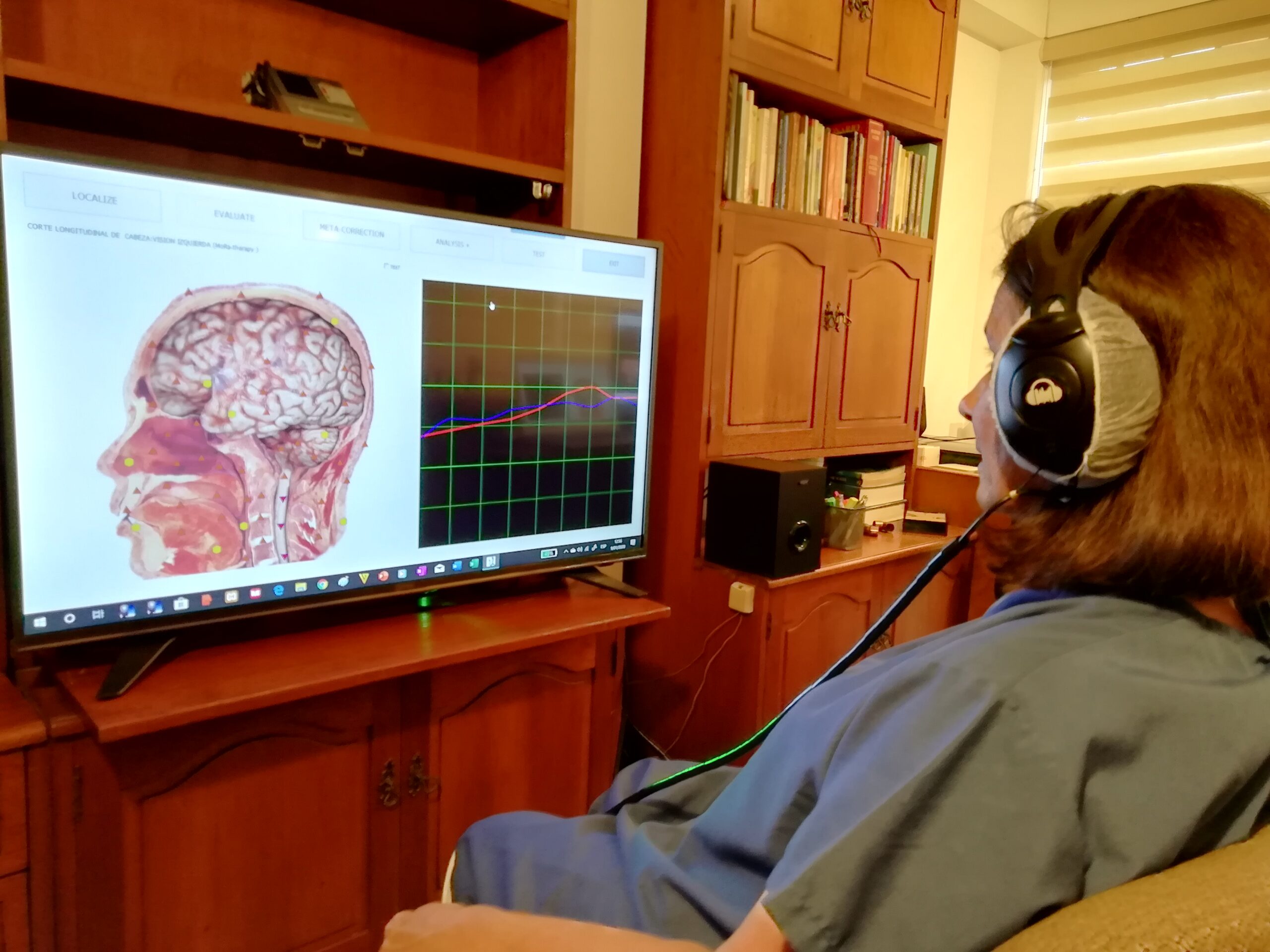 VAR 910 Apuntes sobre biorresonancia magnética